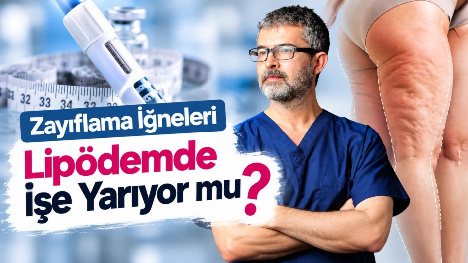 Zayıflama İğneleri Lipödemde İşe Yarıyor mu? Yeni Araştırmalar Lenf Sistemine İşaret Ediyor